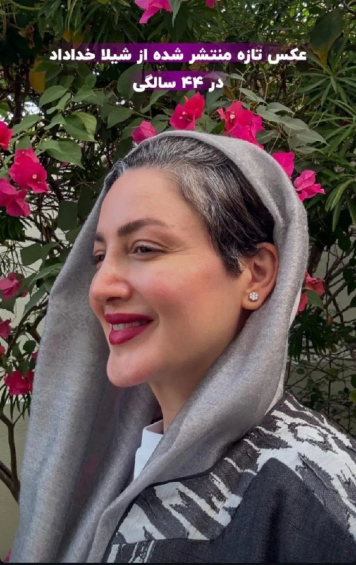 تغییر چهره عجیب و ناگهانی شیلا خداداد در سن 44 سالگی image