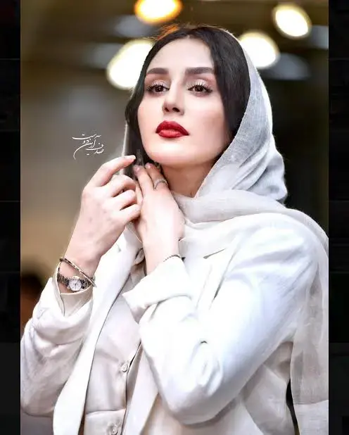 تصاویر دیده نشده | تغییر چهره دیدنی «میترا رفیع» تصاویر دیده نشده | تغییر چهره دیدنی «میترا رفیع»