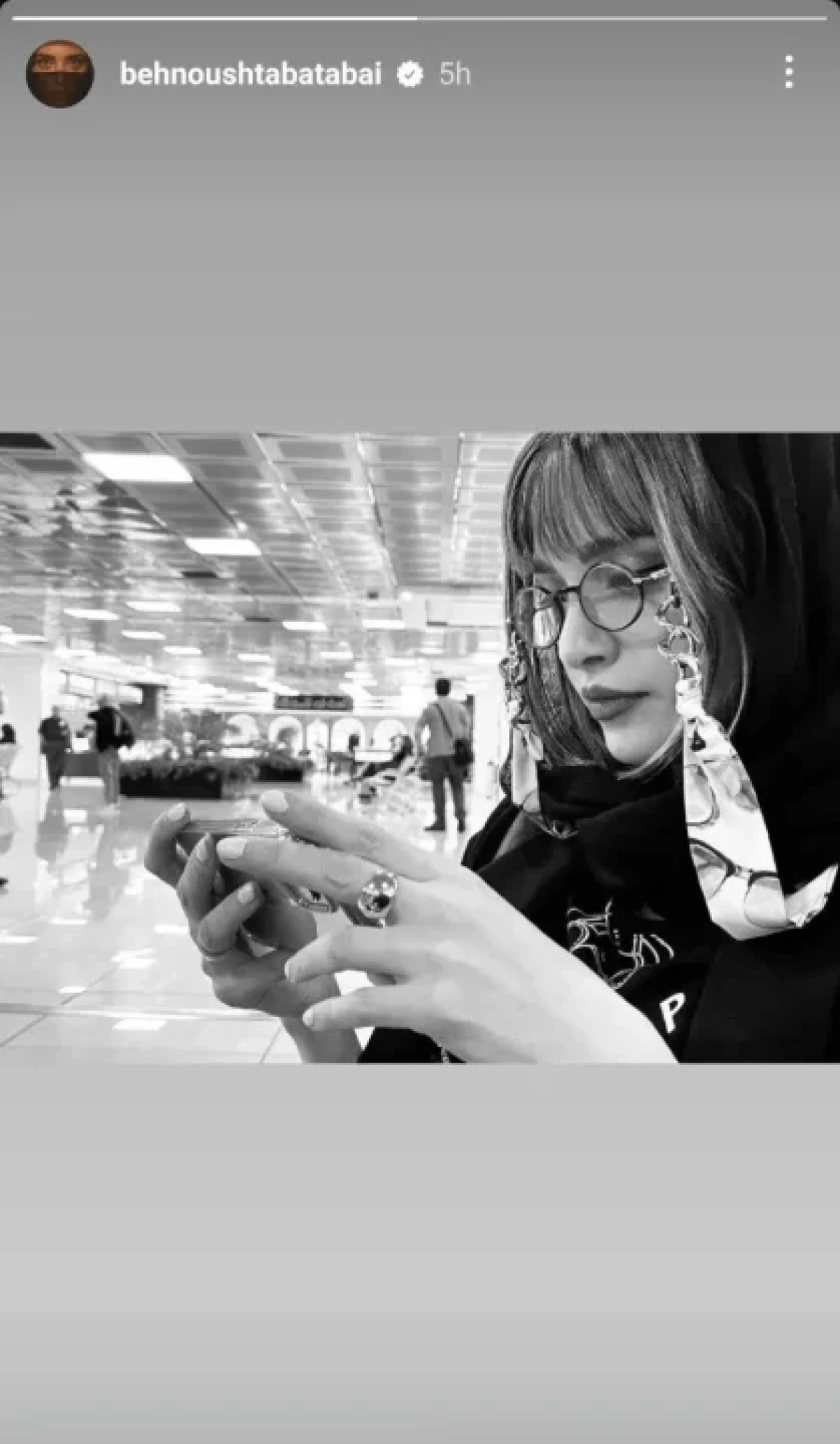 نگاه روز |تغییر چهره «بهنوش طباطبایی» چهره خودش را 20 سال جوان تر کرد نگاه روز |تغییر چهره «بهنوش طباطبایی» چهره خودش را 20 سال جوان تر کرد