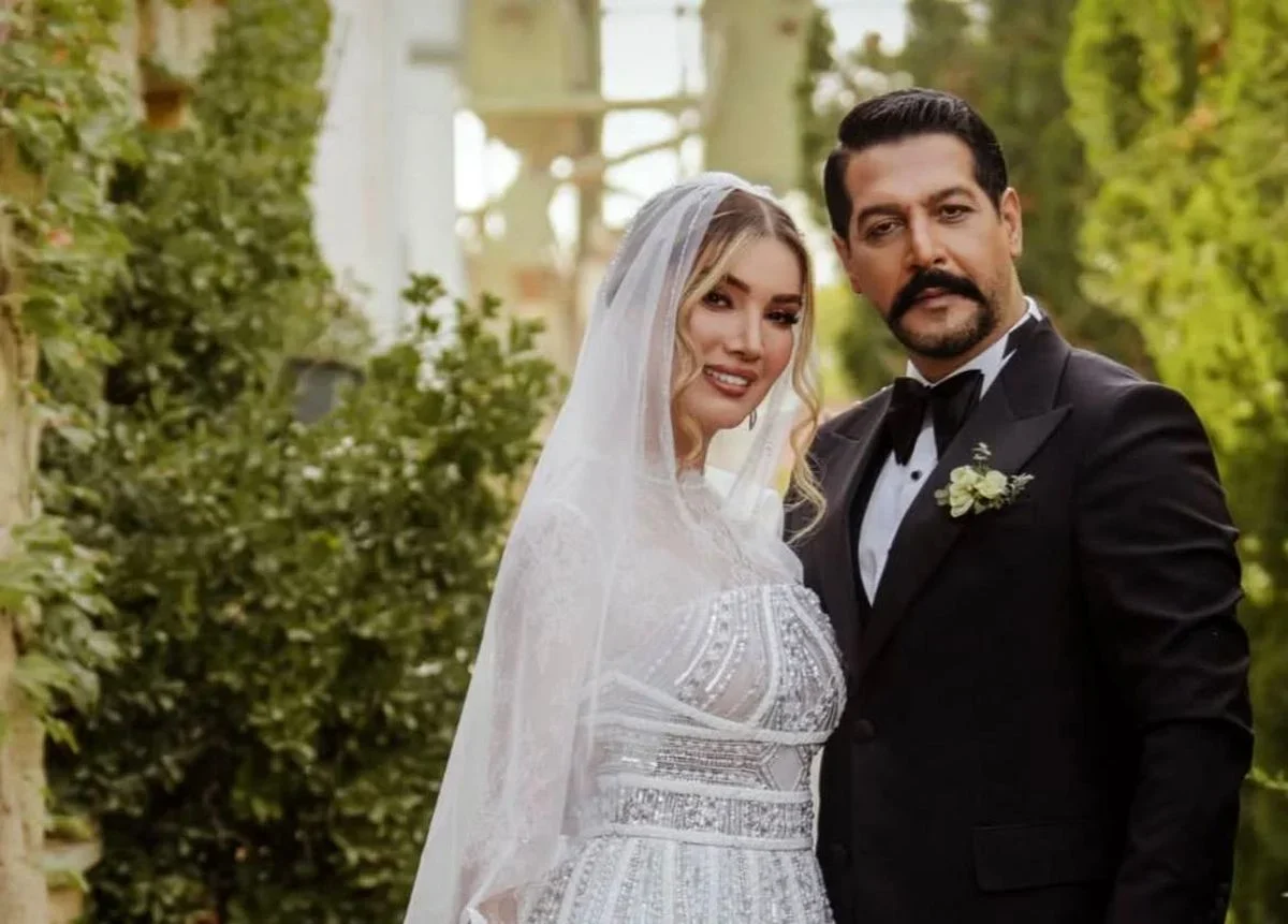 نگاه روز |عکس پربازدیدِ متین ستوده قبل از عمل‌های زیبایی