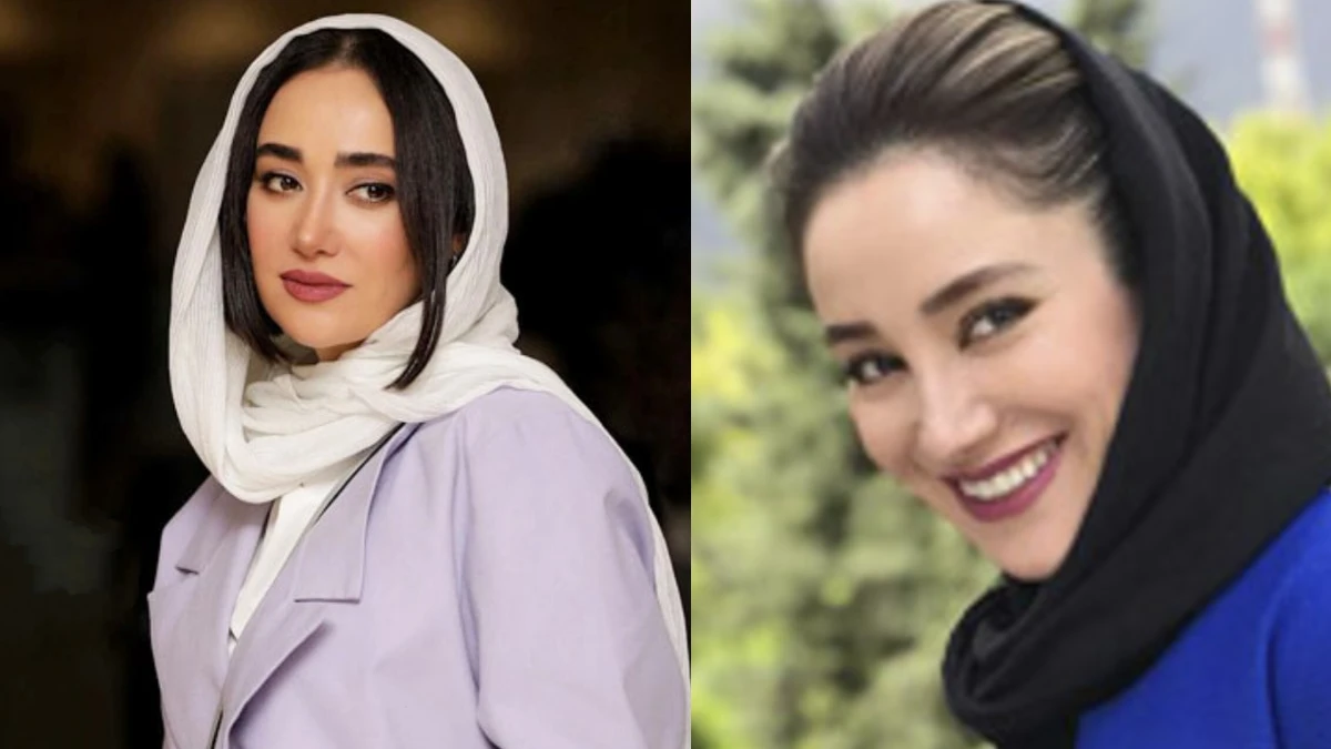 نگاه روز | چهره عجیب و ناگهانیِ بهاره افشاری نگاه روز | چهره عجیب و ناگهانیِ بهاره افشاری