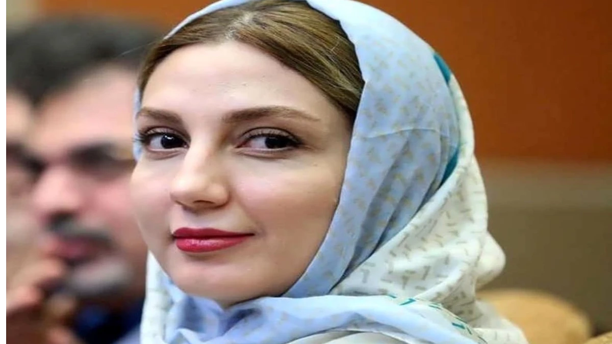 نگاه روز | تغییر چهره حدیث میرامینی بعد از جوکر نگاه روز | تغییر چهره حدیث میرامینی بعد از جوکر