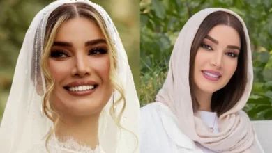 نگاه روز |متین ستوده در خانه پدری و قبل از عمل های زیبایی