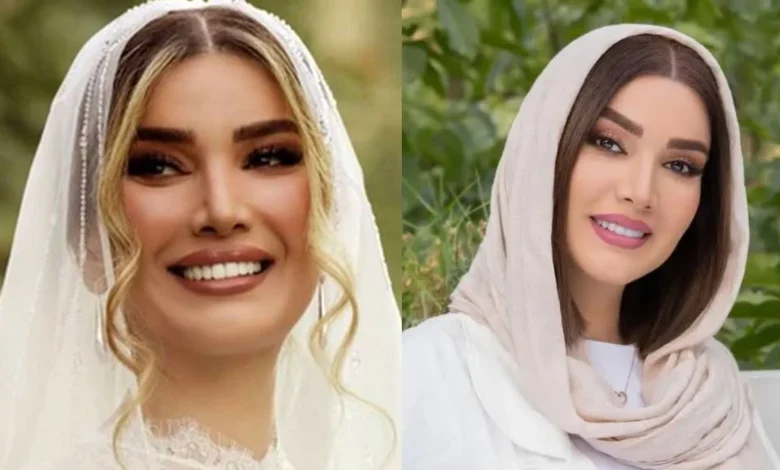 نگاه روز |متین ستوده در خانه پدری و قبل از عمل های زیبایی نگاه روز |متین ستوده در خانه پدری و قبل از عمل های زیبایی